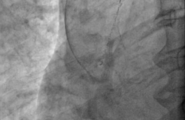 001 CathLab Gallery