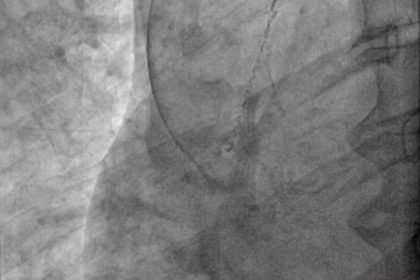 001 CathLab Gallery