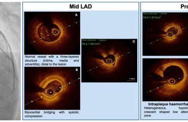 Clinical vignette