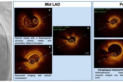 Clinical vignette